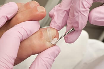 When Does an Ingrown Toenail Require a Visit to the Podiatrist?: Arizona  Foot & Ankle Specialists : Podiatric Medicine and Surgery